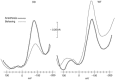 FIGURE 9.4. Individual voltammograms obtained from the striatum of a transgenic (HD) and a wild-type (WT) mouse during anesthesia and subsequent waking (behaving).