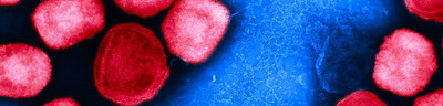 Colorized transmission electron micrograph of mopox virus particles (red) cultivated and purified from cell culture. Image captured at the NIAID Integrated Research Facility (IRF) in Fort Detrick, Maryland. Credit: NIAID